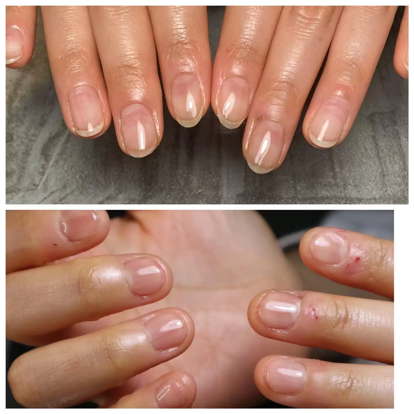 3回目でこんなに変わりました♡お電話 0827-28-5224・LINE @duu5064m ・ホットペッパービューティー・インスタグラムDM【施術中は電話に出られない場合があります】#山口県ネイルサロン#山口県ネイル#山口県ジェルネイル#岩国市#岩国ネイル#岩国ネイルサロン#岩国ジェルネイル#岩国一層残し#一層残し#フィルイン#iwakuni #シンプルネイル#山口県一層残し#ニュアンスネイル#ニュアンスネイルアート#岩国ニュアンスネイル#広島県#広島ジェルネイル#広島ネイルサロン#広島一層残し#サンシャインベビーエデュケーター#momo_os山口#プライベートサロン#美爪 #美甲#冬ネイル#フットネイル#ねこ#深爪#深爪矯正